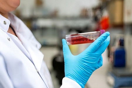 Virus Transport Kit (Non-Inactivated)-Ligtas na koleksyon ng sample ng viral