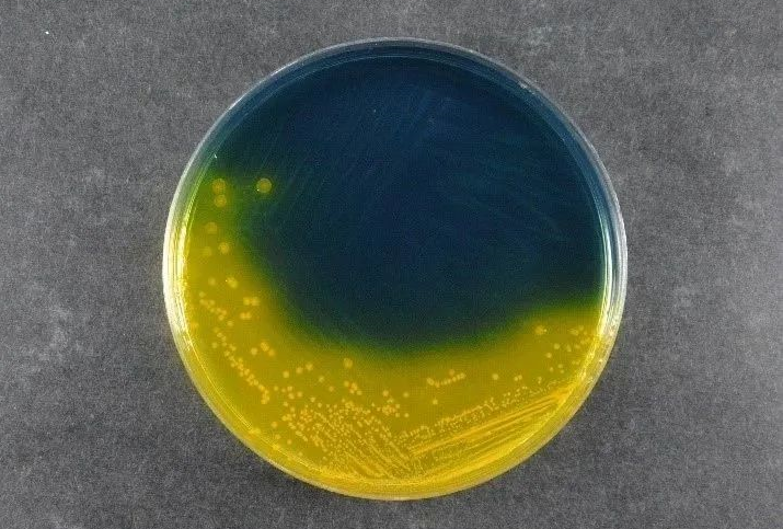 Tinitiyak ang Kaligtasan ng Pagkain: Sinusuportahan ng Salmonella Shigella Agar (SS) ng Babio ang Mga Pamantayan sa Pagtuklas ng Global Pathogen