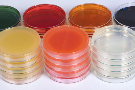 Triple Sugar Iron Agar (TSI): Tumpak na Pagkita ng Enteric Bacilli na may Babio