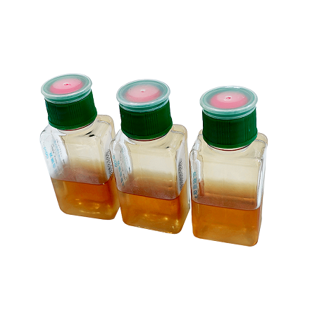 Bakit mahalaga ang pagpili ng isang naaangkop na microbiological culture medium para sa diagnosis?