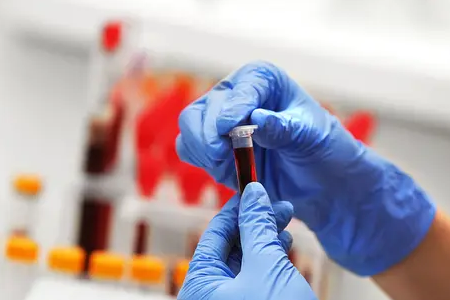 Rapid Malaria Detection: Ang Dual Antigen Test Kit ng Babio ay nagbibigay lakas sa pandaigdigang kalusugan