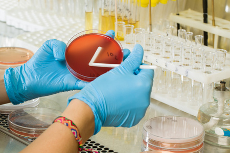 MacConkey Agar Medium ng BABIO - Premium Selective Isolation para sa Global Microbiological Diagnostics