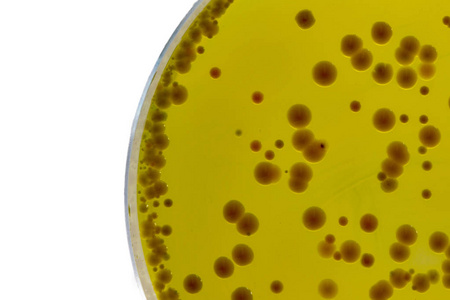 Sinusuportahan ng BABIO Mueller-Hinton Broth ang Maaasahang Antimicrobial Susceptibility Testing