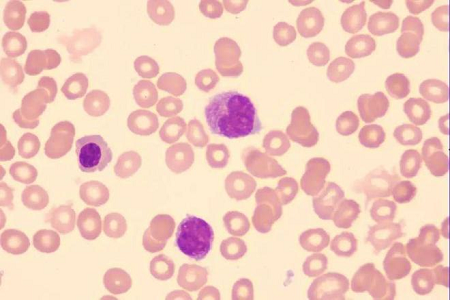 Piglet Paratyphoid Vaccine Medium para sa Veterinary Vaccine Production