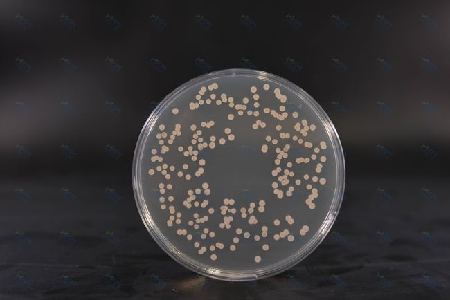 Brain Heart Infusion Agar: Medium na Mayaman sa Nutrient para sa Kultura ng Bakterya